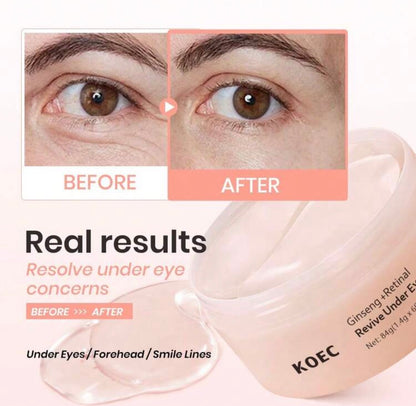 KOEC Eye Mask - Moisturizing Ice Compress Eye Patches, Korean Skincare, Reduce Dark Circles, Eye Area Hydrating Ice Compress Stickers Kadosh on Beauty